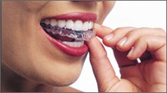 Invisalign #1